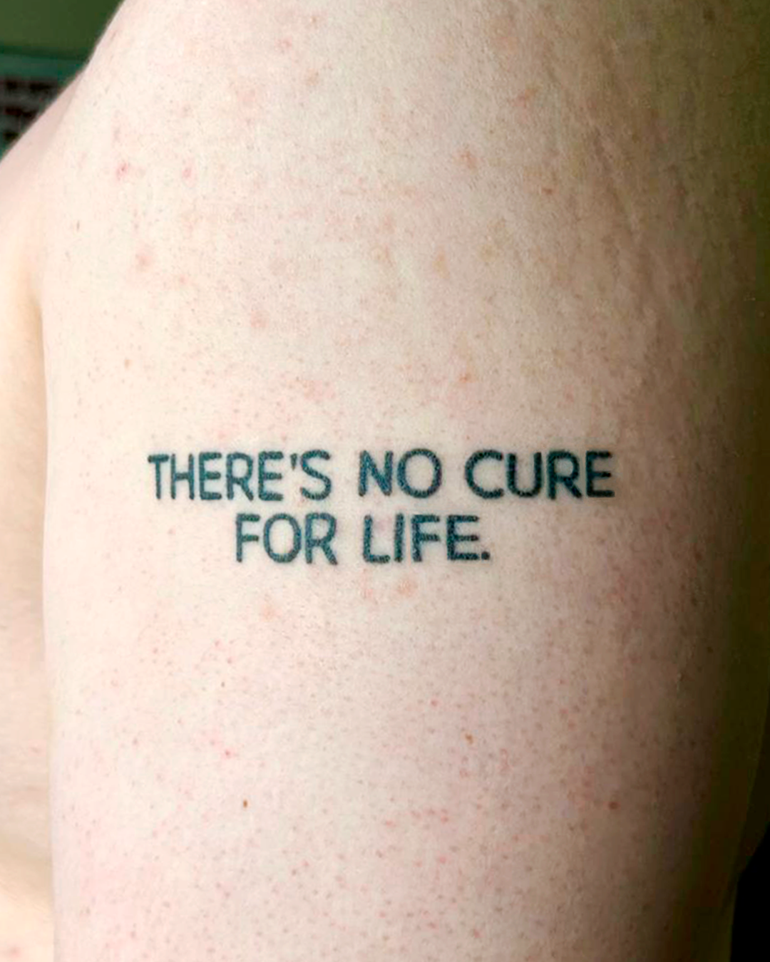 tatuagem handpoke (cicatrizada)