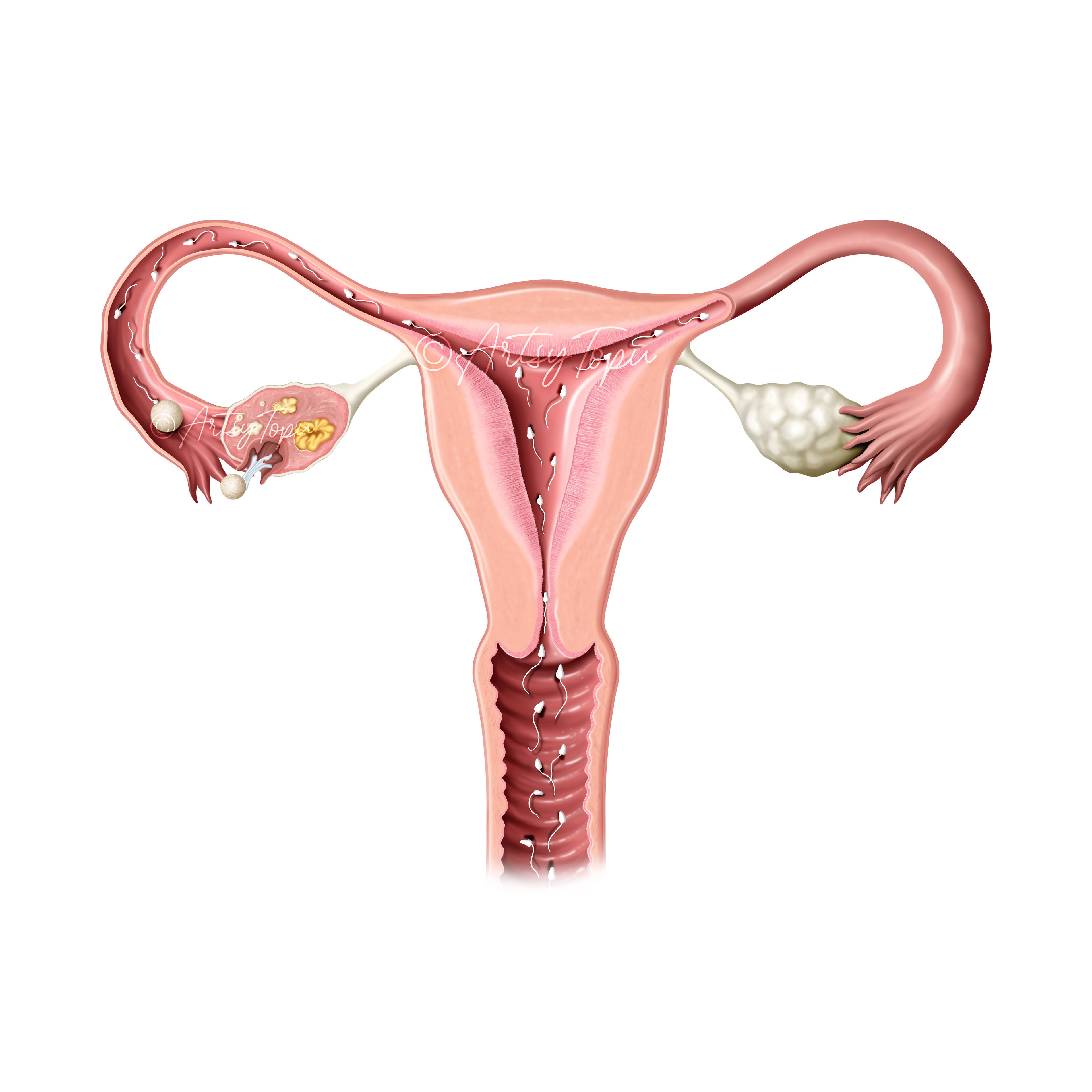 Female Uterus with sperm in side it. illustration