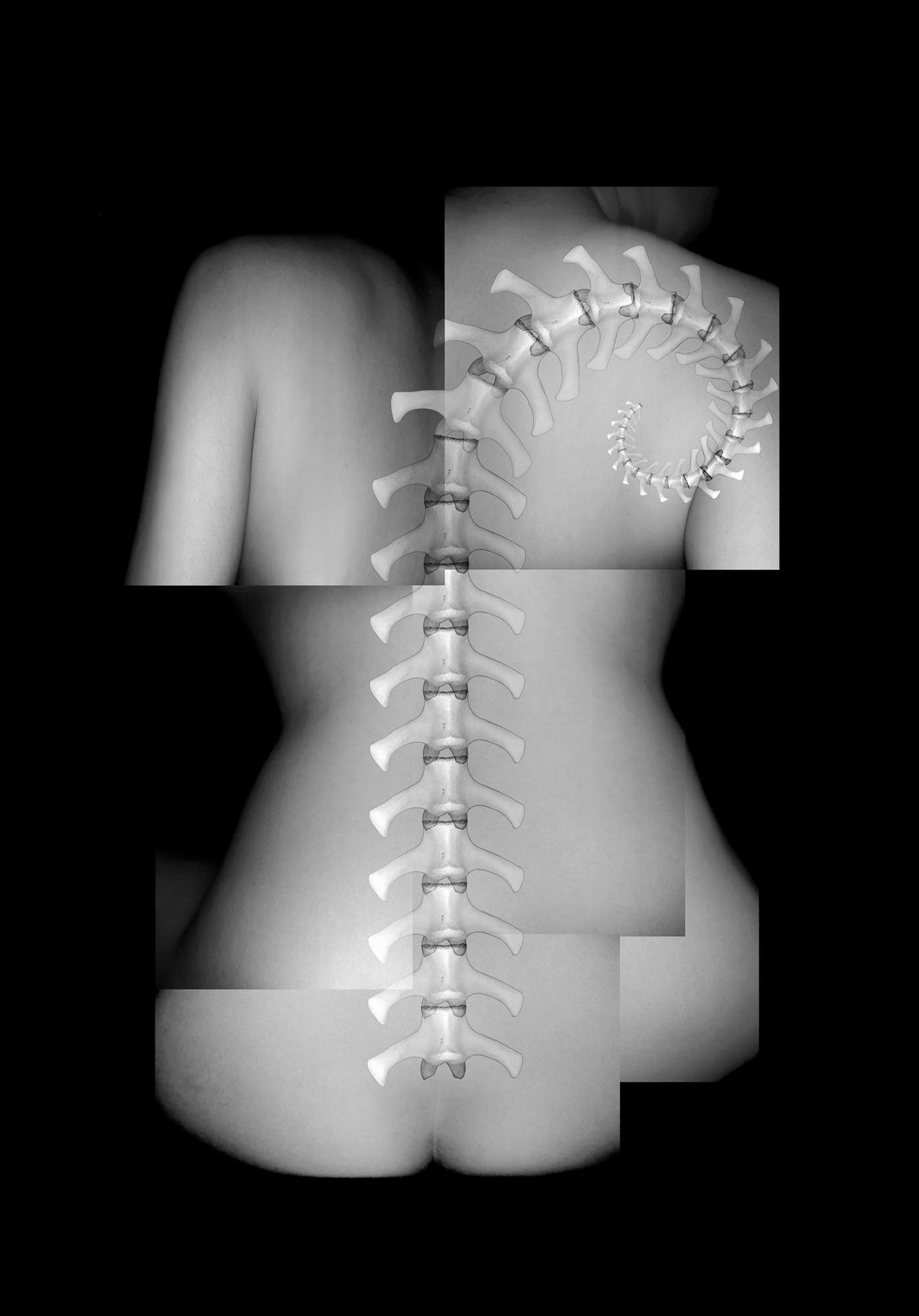 Epidural Space, 2003, archival pigment print, 21.5x15"