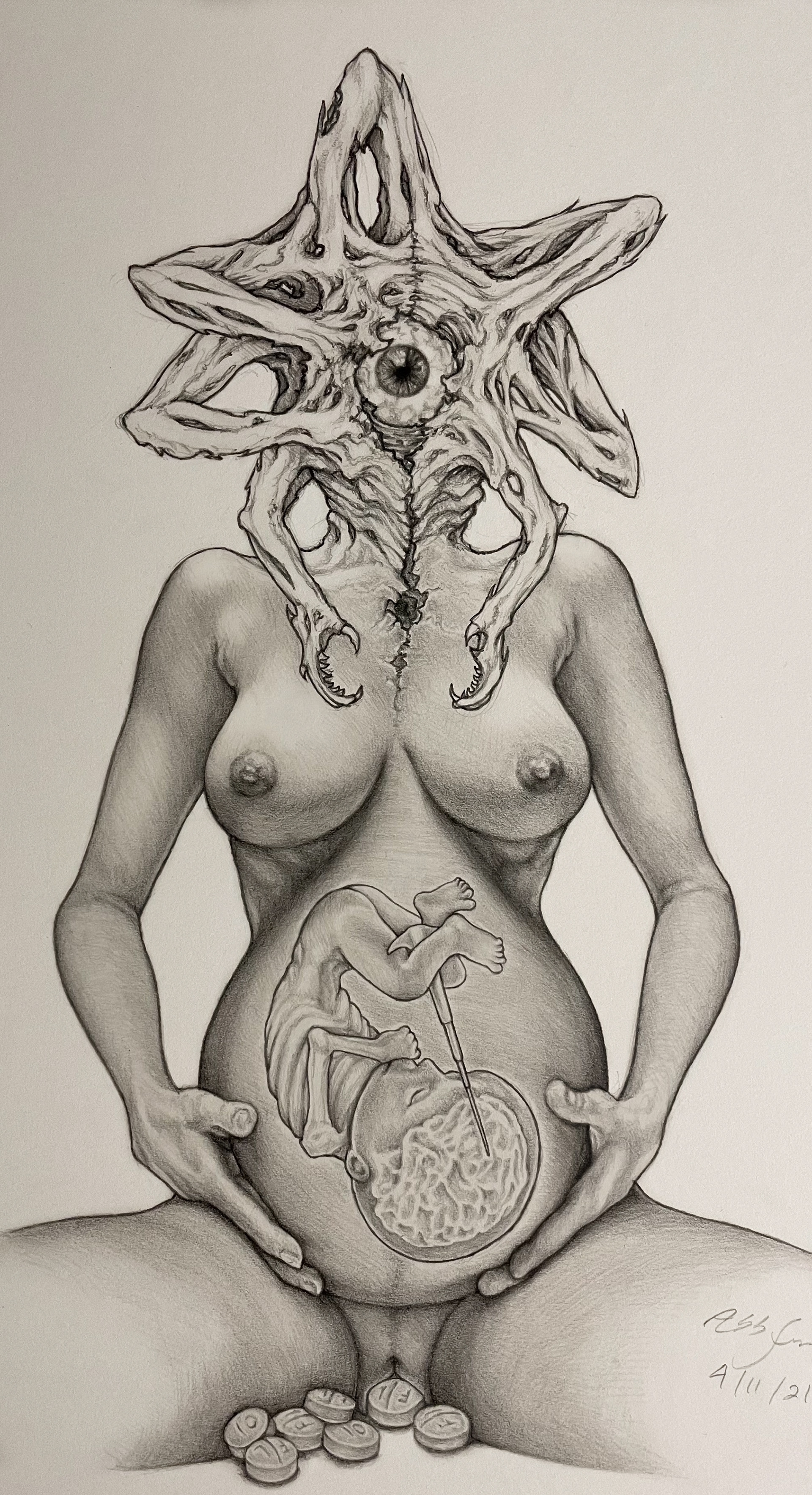 (Age 23) What Have You Done [Quick Draw]