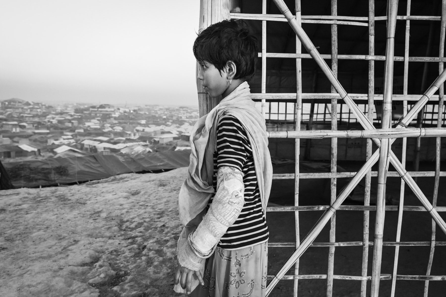 Azida , eight years old from Boli Bazar in Maungdaw township. Her father was shot and killed when the village was attacked. She has five sisters and brothers, two other brothers were killed during the attack. While fleeing and crossing the border she fell and broke her arm. She has been for 10 weeks in Bangladesh with her remaining family. Kutupalong refugee camp, Bangladesh, November 2017