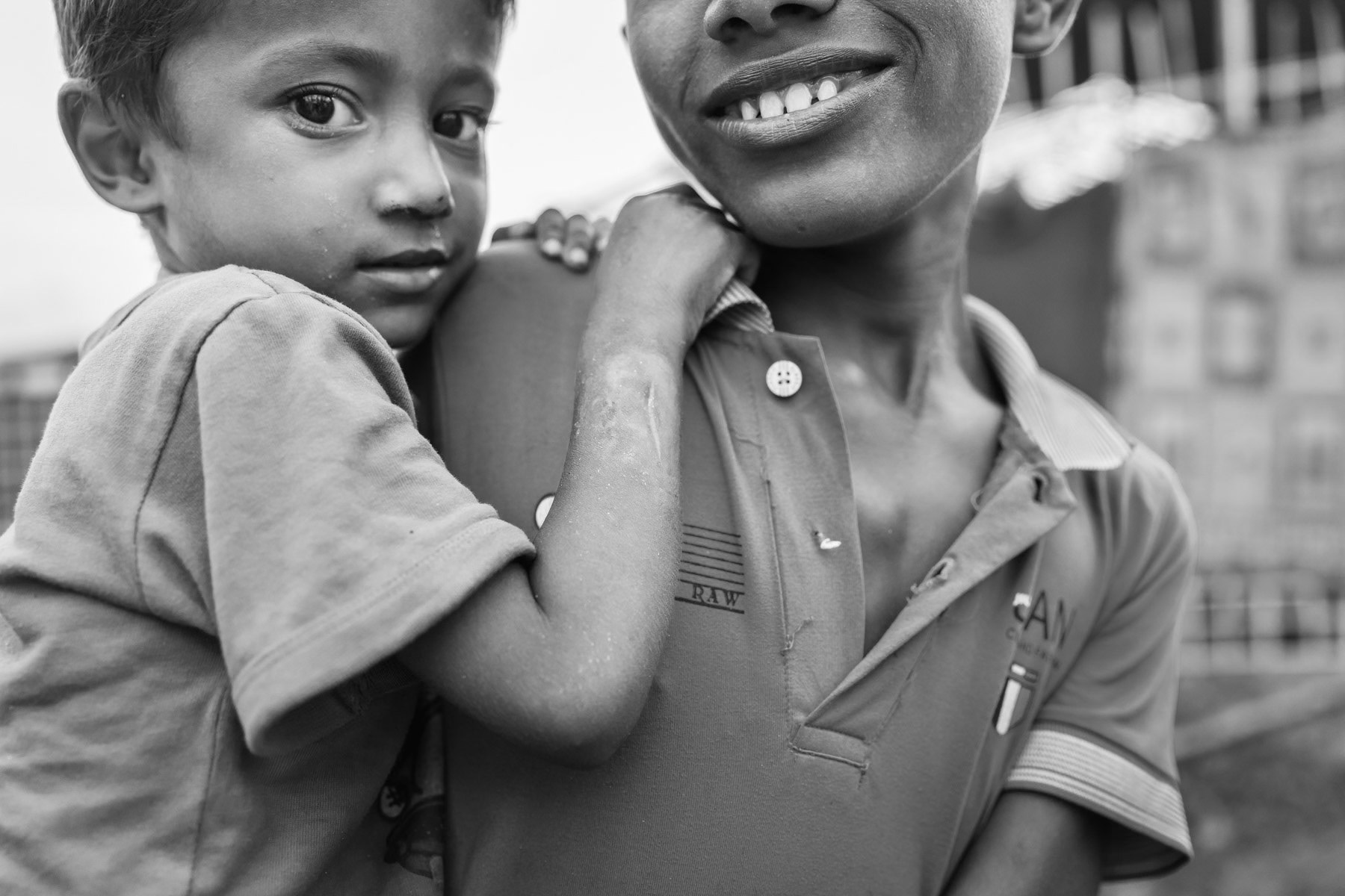 Mohamed Ziarad and his 3 year old brother were hit by helicopter fire while their village near Buthidaung in Myanmar was attacked. After several days walk through the jungle they found refuge in Bangladesh as the more than 650,000 Rohingya refugees that have fled Myanmar since August 2017. Lambashiya section of Kutupalong refugee camp, Ukhiya, Bangladesh, November 2017