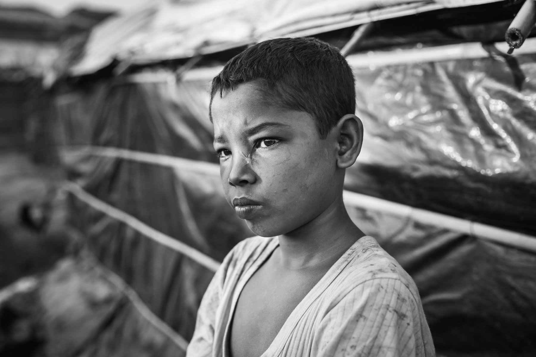 Mohamed Anosh is 10 years old and from Rabailla near Maungdaw. He was hit by a shrapnel from a helicopter shell just under the eye. It took him seven days to reach Bangladesh. He witnessed the execution of his parents by the Burmese military. He came and lives with his grandmother. He lost every track of his younger brother since the attack. Kutupalong refugee camp, Bangladesh, November 2017