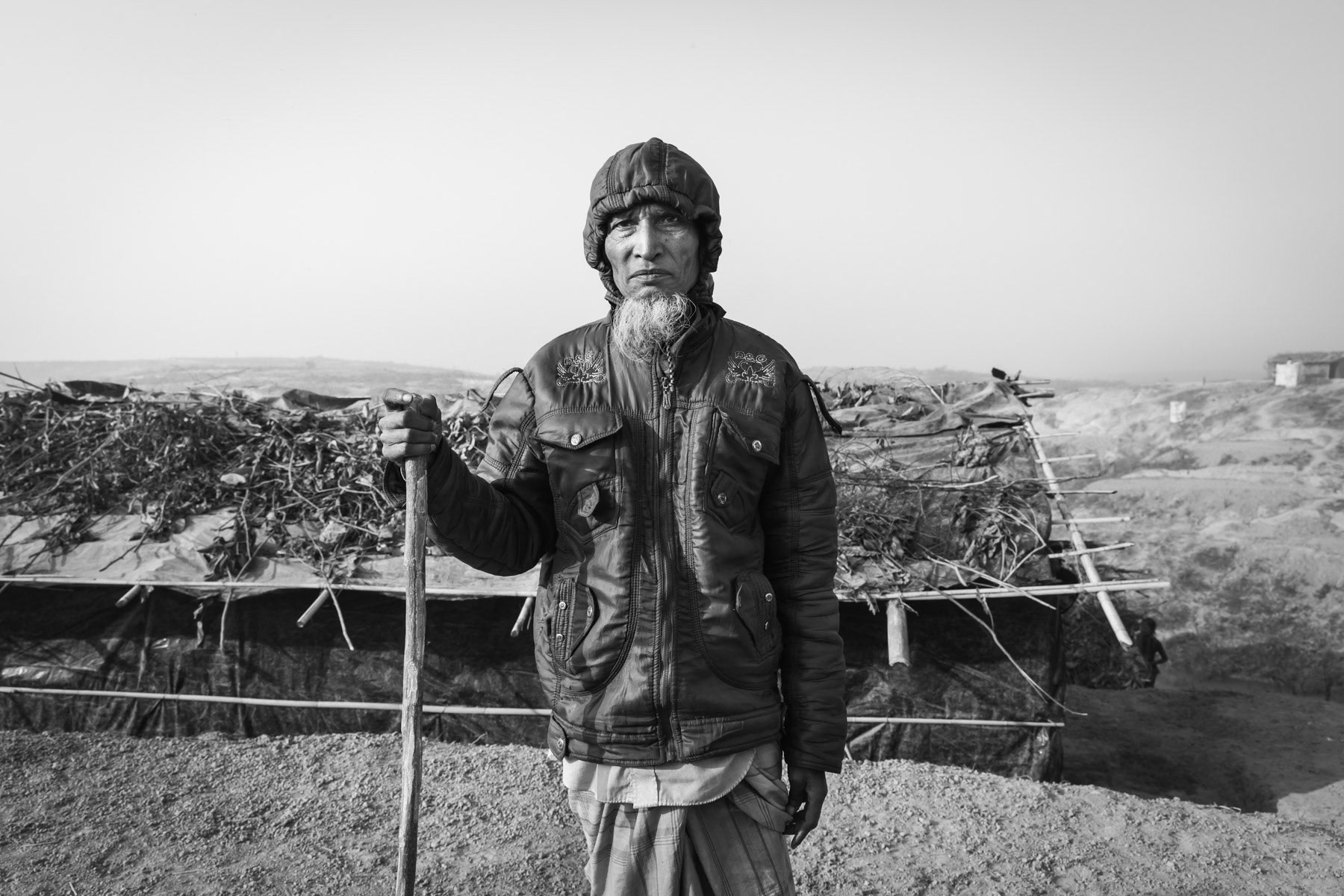 Rohingya refugee from north Maungdaw township wounded by shrapnel while his village was attacked by the Burmese army. Fled to Bangladesh in January 2017. Kutupalong refugee camp, Cox's Bazar district, Bangladesh, February 2017