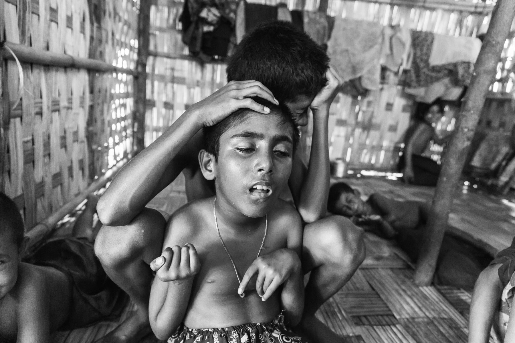 Rohingya child paralysed since birth, with no access to proper basic health care for the Rohingya population, there is no hope and possibility to get any specialist health support. Dar Paing internment camp for Rohingya near Sittwe, Myanmar, May 2016
