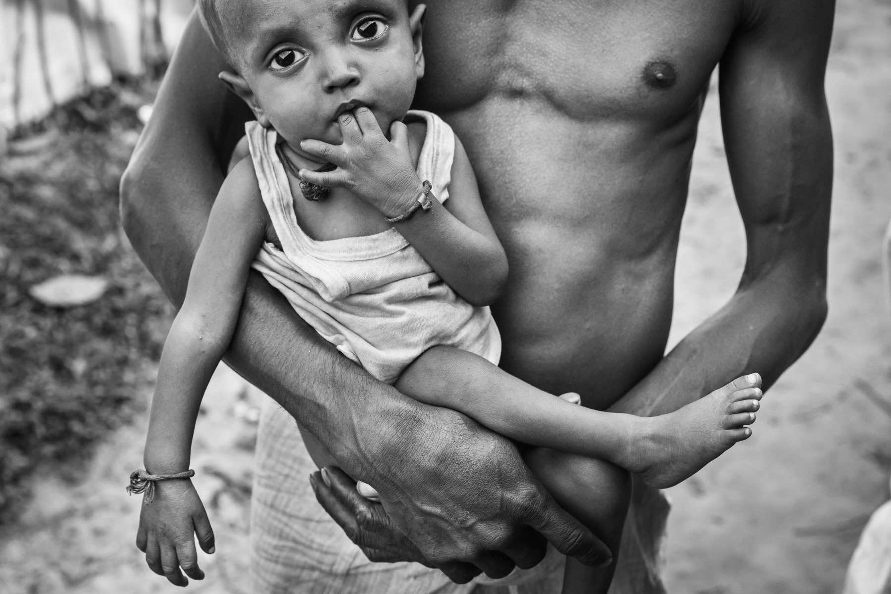 Rohingya refugee that arrived recently from Buthidaung township in Myanmar with his 18 months old malnourished baby. Balukhali camp, Cox's Bazar, Bangladesh, May 2017