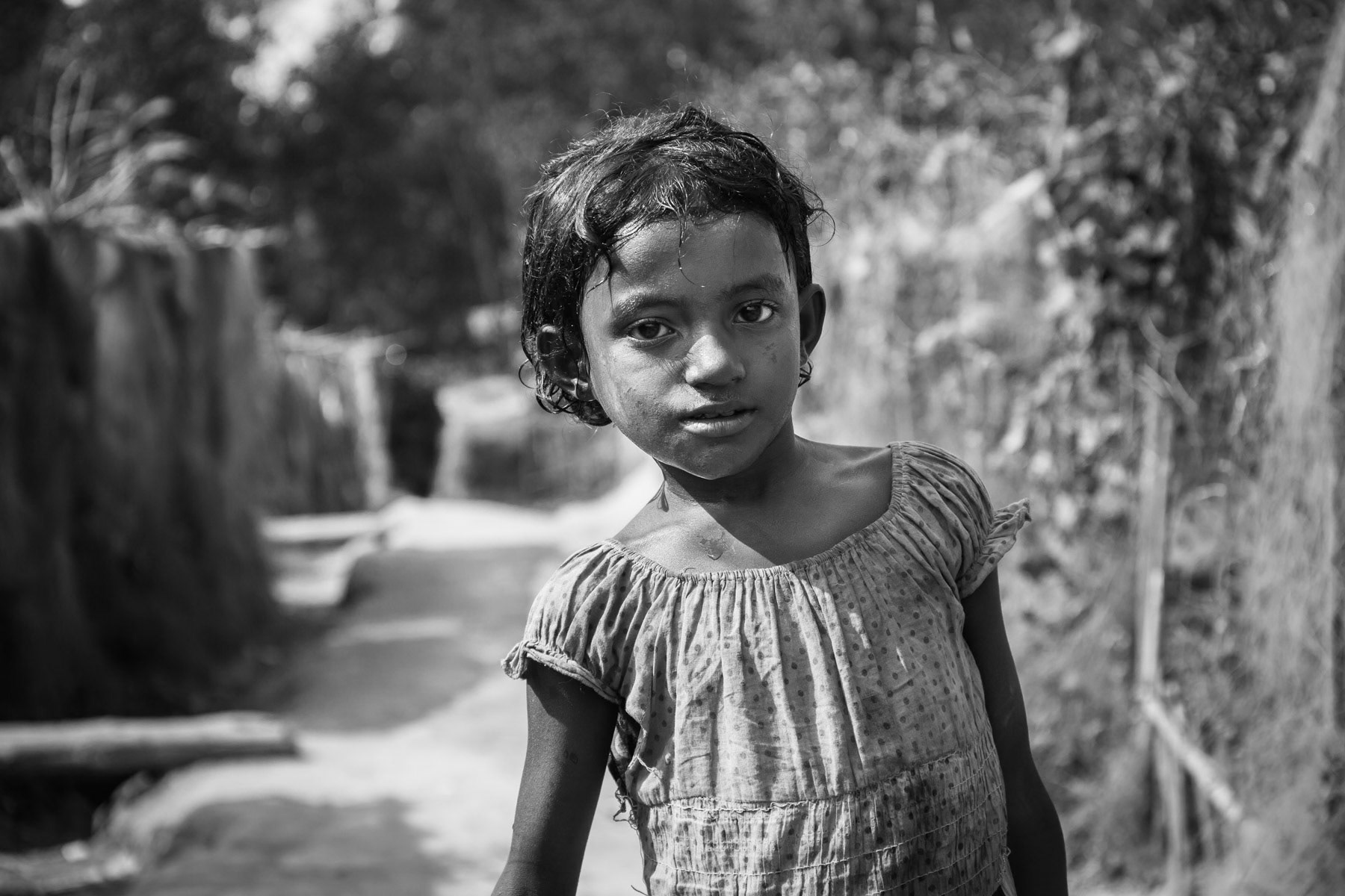 Stateless Rohingya refugee in Bangladesh, Teknaf, December 2015