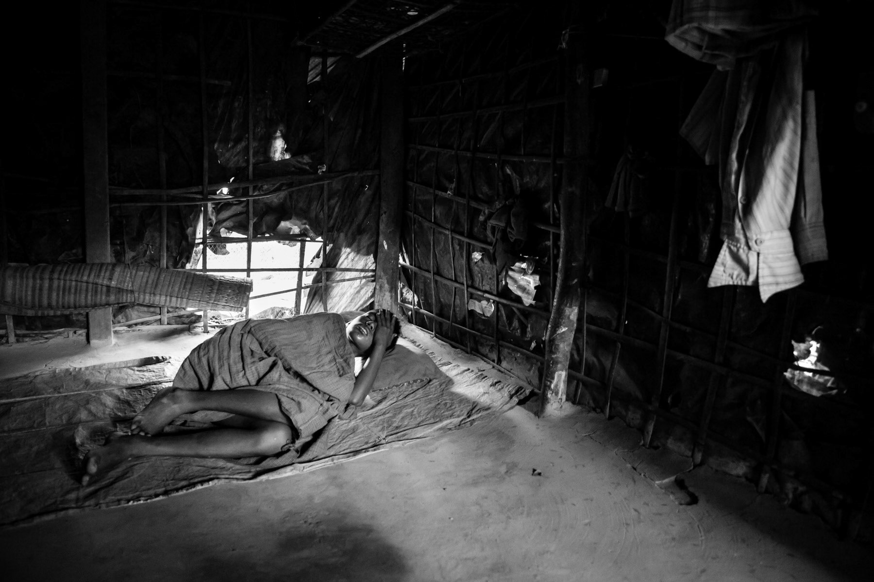 Rohingya child with malaria. With no access to free medical care, the un-registered refugees have no access to doctors and medicine and often die of otherwise curable diseases. Makeshift refugee camp in Shamplapur, Bangladesh, June 2015