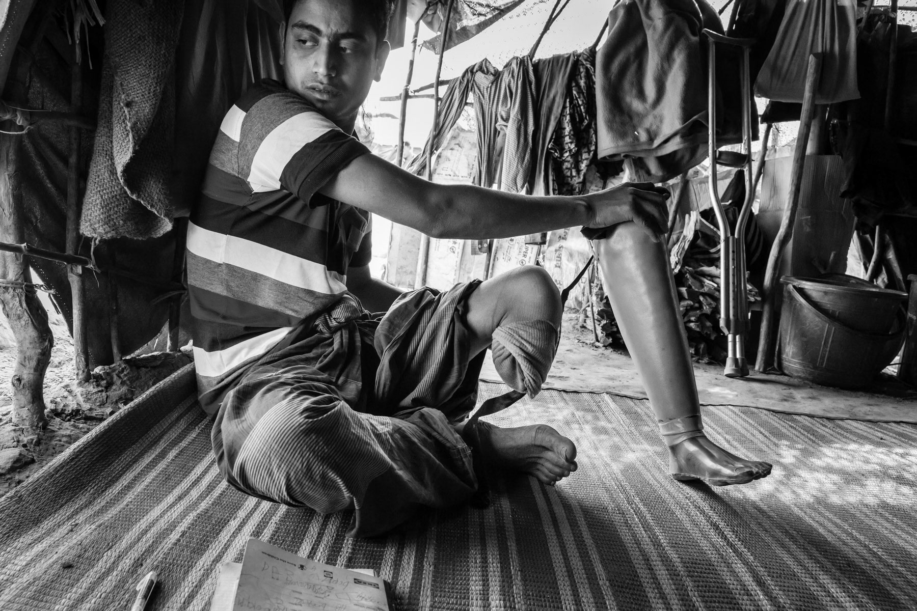 Abdul Karim,19y, Chut Pyin (same village), Rathedaung. He was shopkeeper with his father. Arrived in Sep in BD. Lost his leg, got a prothesis from a donor. Sister, father, brother were killed. Came to BD with one brother and mother. During the attack he was shot in the leg. It took them 7 days to reach BD. Got the first medical care once reaching BD, he was referred to Chittagong where they had to amputate his leg till under the knee as the untreated wound got badly infected. He learns now English to become business man.