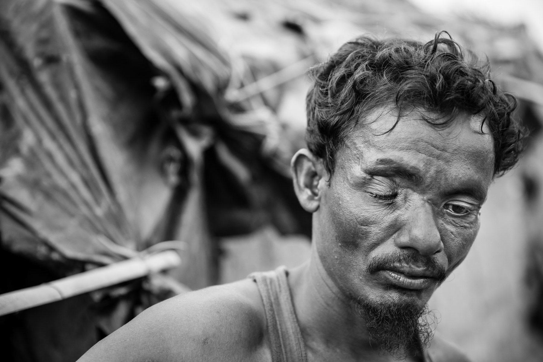 Rohingya refugee arrived end December with his wife and five children. He was tortured and attacked with a machete and is blind on one eye as a result. Kutupalong refugee camp, Cox's Bazar, Bangladesh, May 2017