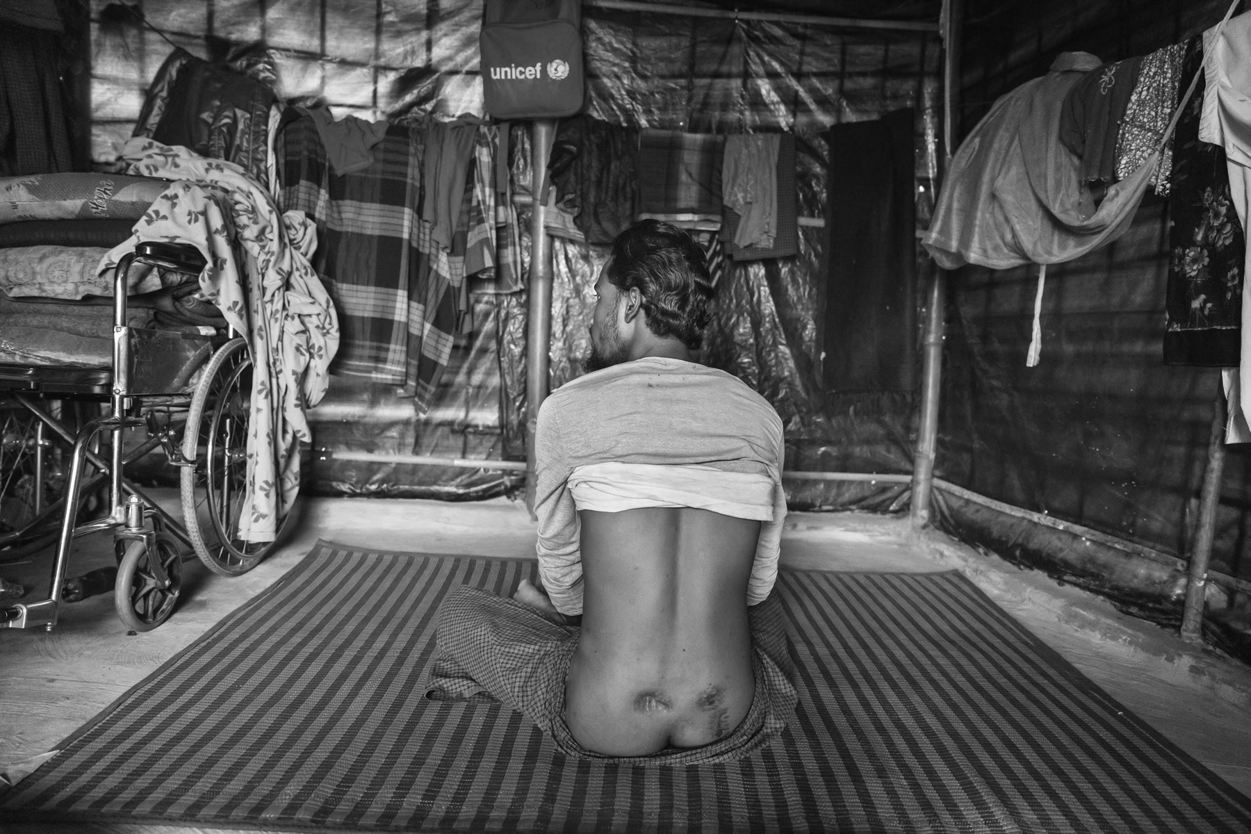 Abdullah, 27 years, arrived in October 2017 from Kulun, Maungdaw. Was shot twice in the back while escaping, fell in the ditch where he was rescued by his brother and friends and carried 4 days before reaching safety in Bangladesh. His mother, wife and both children made it also safely to the other side of the border. Bullets were removed through abdominal surgery. He stayed 10 weeks in hospital. He can walk, but can't go up and downhill. He has received a wheelchair through charity, which is unfortunately useless in the refugee camps. Balukhali refugee camp, Bangladesh, March 2018
