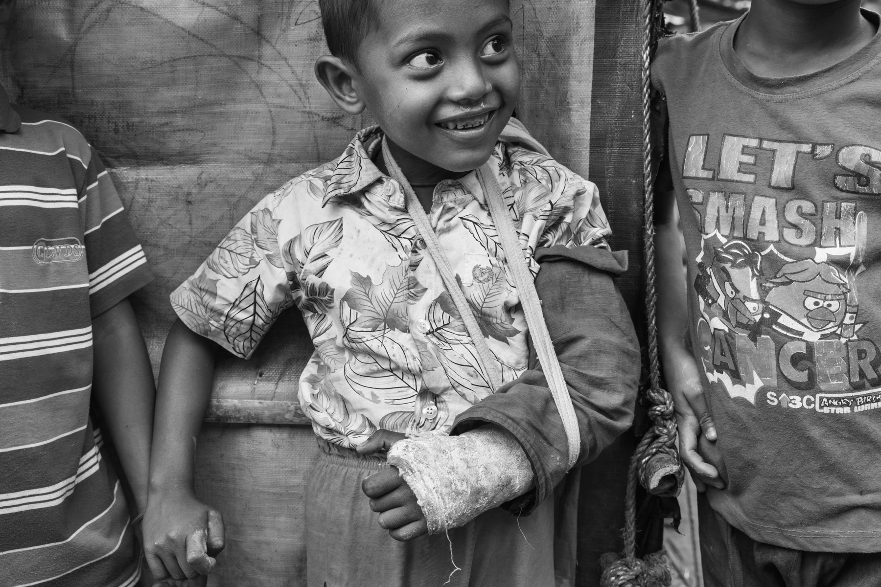 Rohingya child who broke his arm while playing. Several clinics and health post have been set up in the refugee camps since last year's large influx. But with more than one million refugees in the camps, the services are streched to the extreme and insufficient to reach all in need. Balukhali refugee camp, Ukhiya, Bangladesh, March 2018