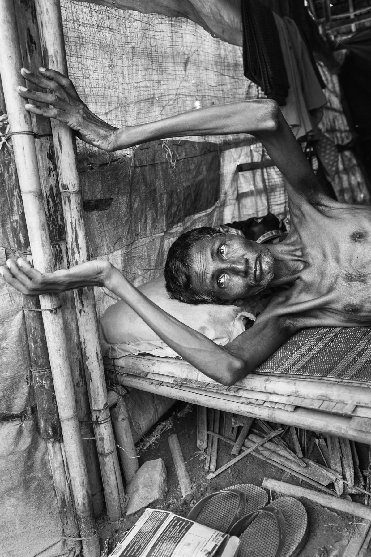 Suffering of tuberculosis, with no access to healthcare and medicine since the expulsion of Medecins Sans Frontieres from the camps. MSF was the sole organisation providing primary healthcare to the Rohingya population. After denouncing ethnic cleansing operation in the region they were expelled from Rakhine. Thau Chuang camp, Sittwe, Myanmar, September 2015