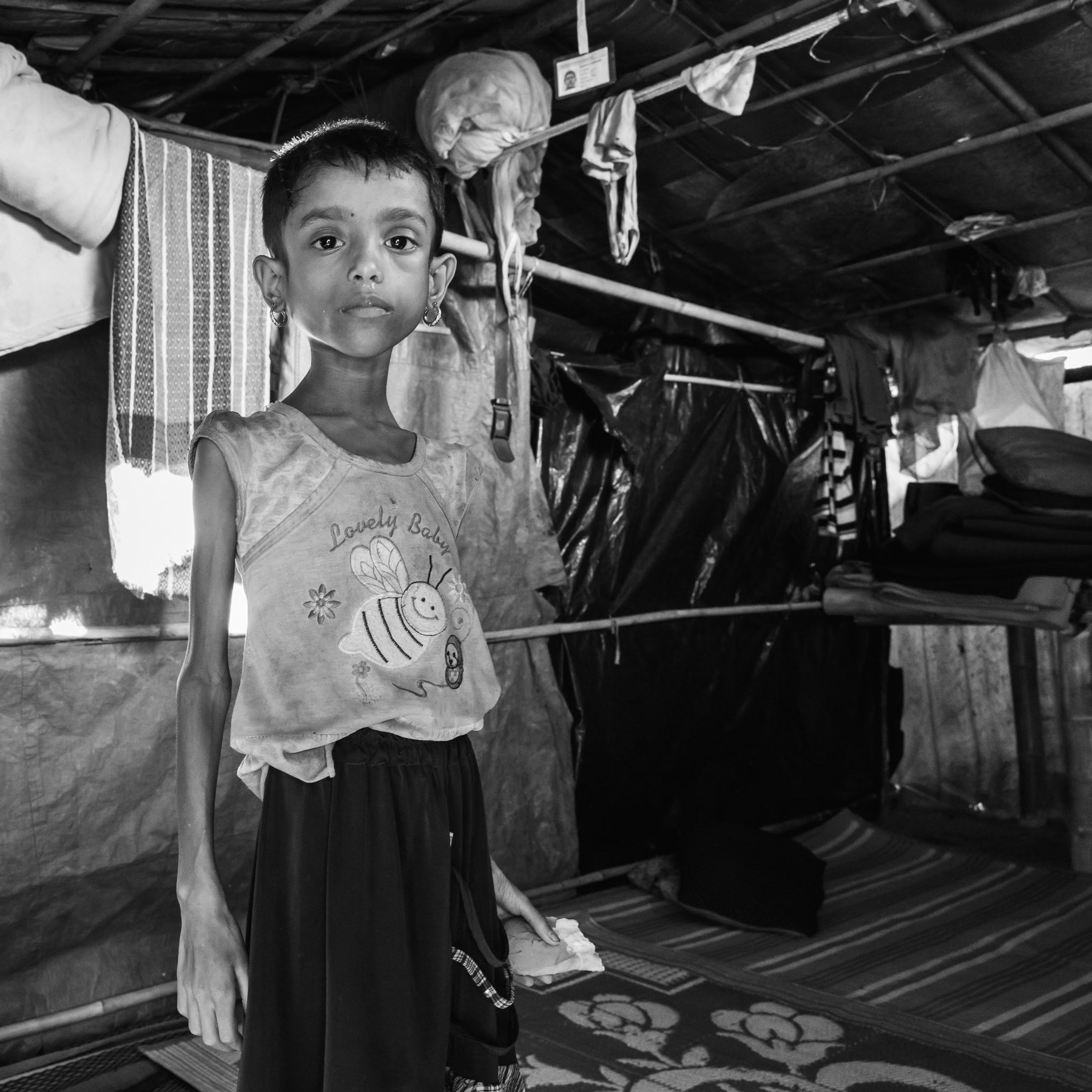 Azida B., 6 years old Rohingya refugee from Sanifara near Maungdaw in Myanmar. She was snatched in her village by Burmese military and forced to drink car battery acid. Ever since she has lost more than half her weight as she can't digest any food and is vomitting constantly. She fled immediately after the attack with her parents to Bangladesh where she is being treated in a clinic. In March 2018 she was still recovering and was slightly better. Balukhali refugee camp, Cox's Bazar, Bangladesh, November 2017