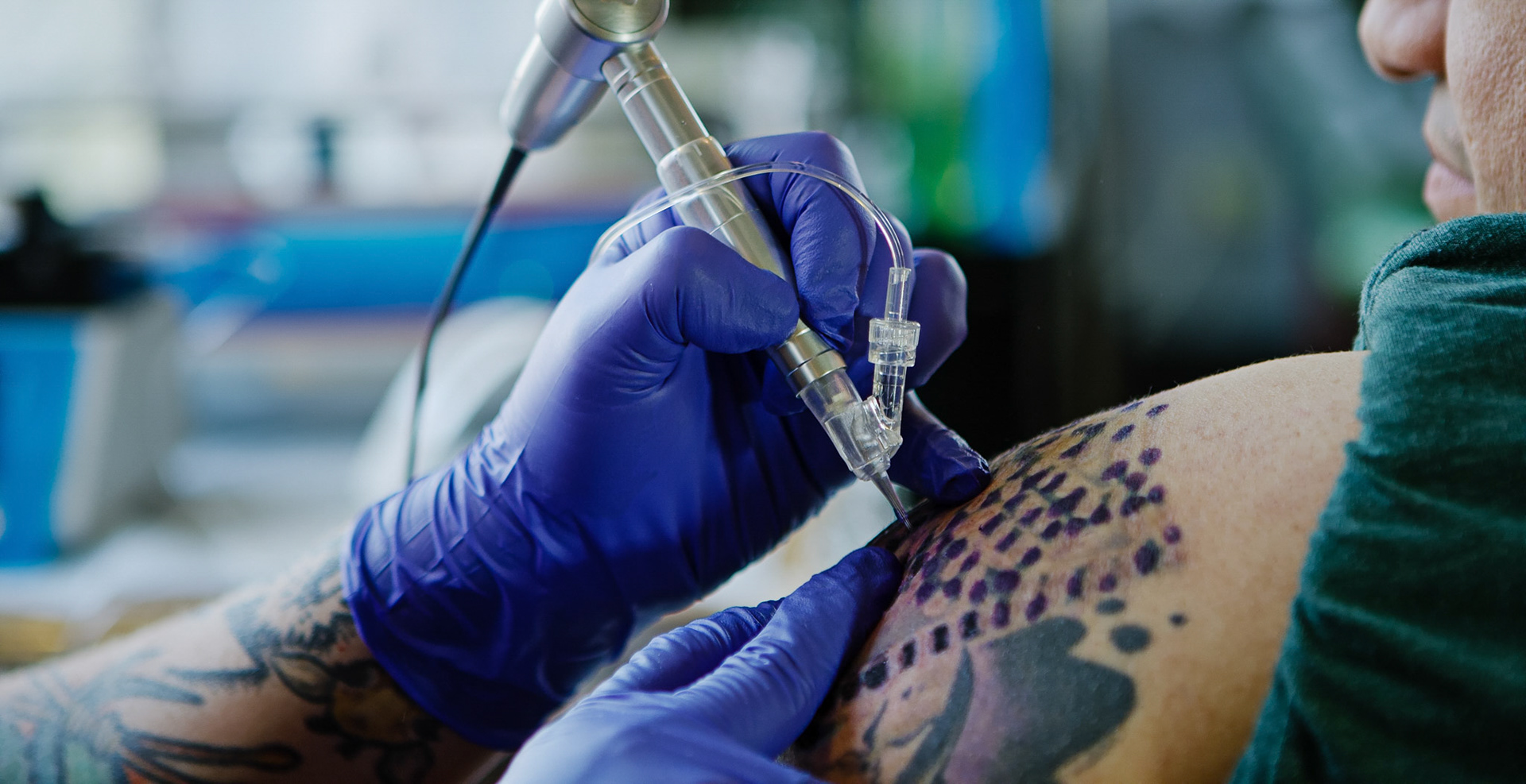 TattooAway