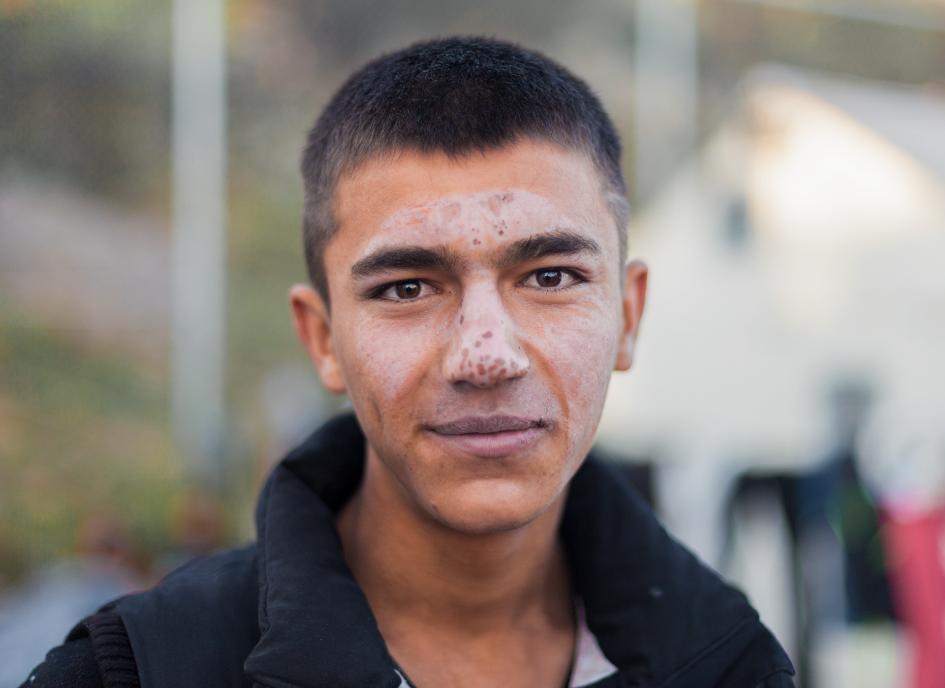 Hasebullah, a 15 years old Afghani boy, poses for a portrait at the meeting site at Sykamanea on the island of Lesvos Greece after just arriving from Turkey. Hasebullah left Afghanistan to escape the fighting like the road side bomb that scarred his face, wounded his leg and killed five other people. 