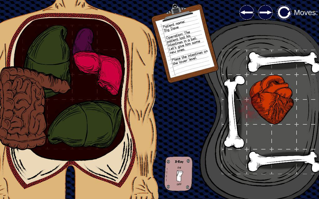 body with organs in operating table
