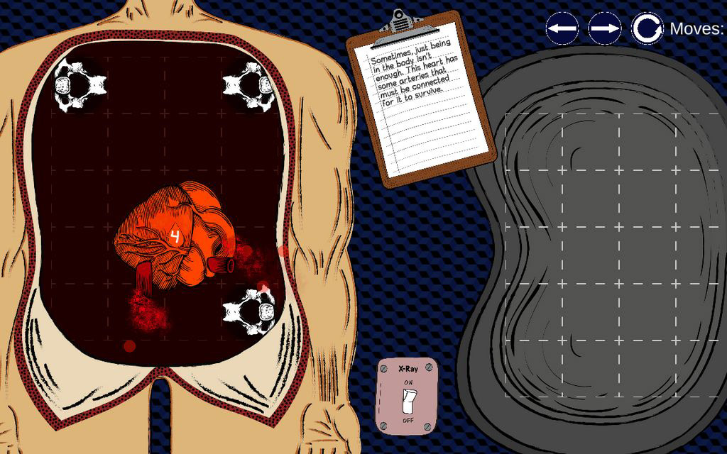 body in operating table