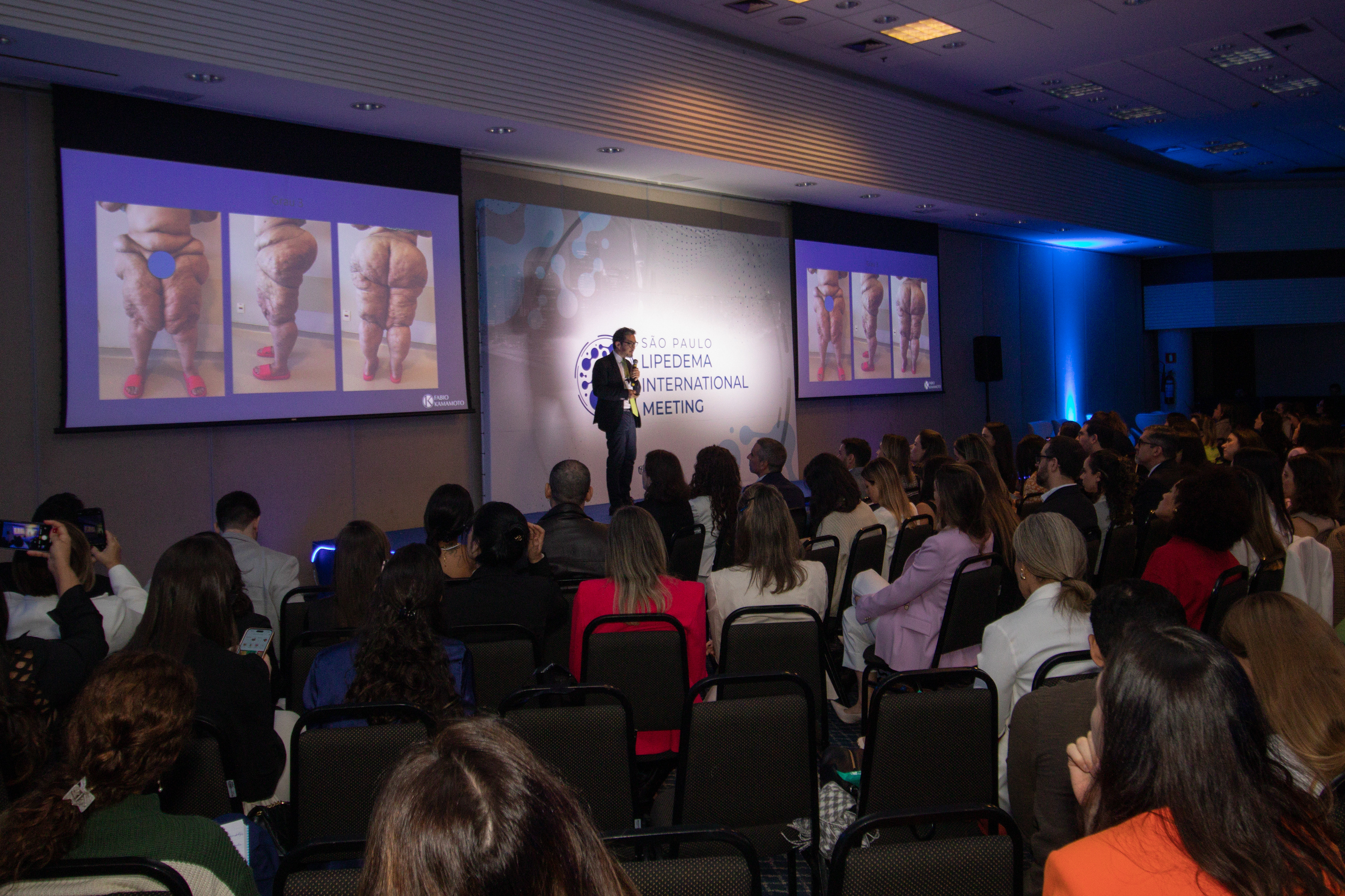 Lipedema Internationl Meeting