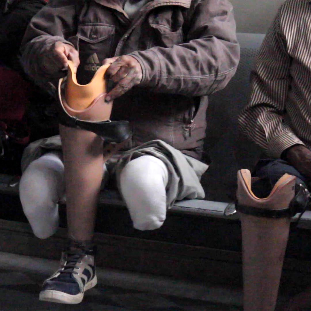 After no time at all, he had been fitted with new legs.