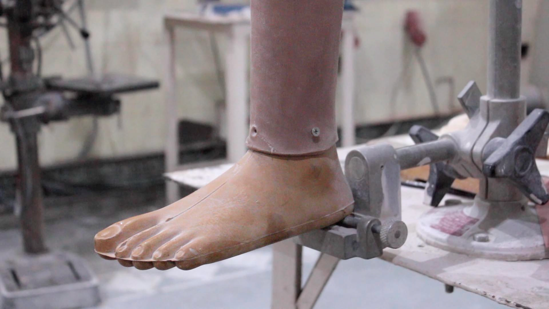 The Jaipur Foot