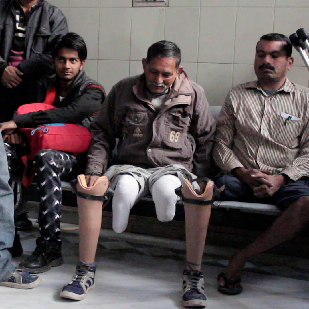 One man who had lost both legs below the knee.