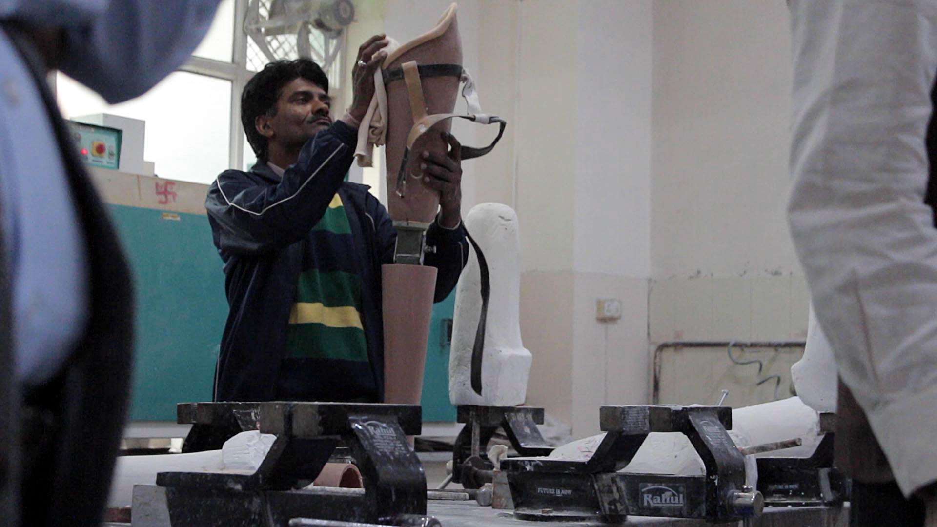 Cleaning an above-knee prosthesis known as the Jaipur Knee.