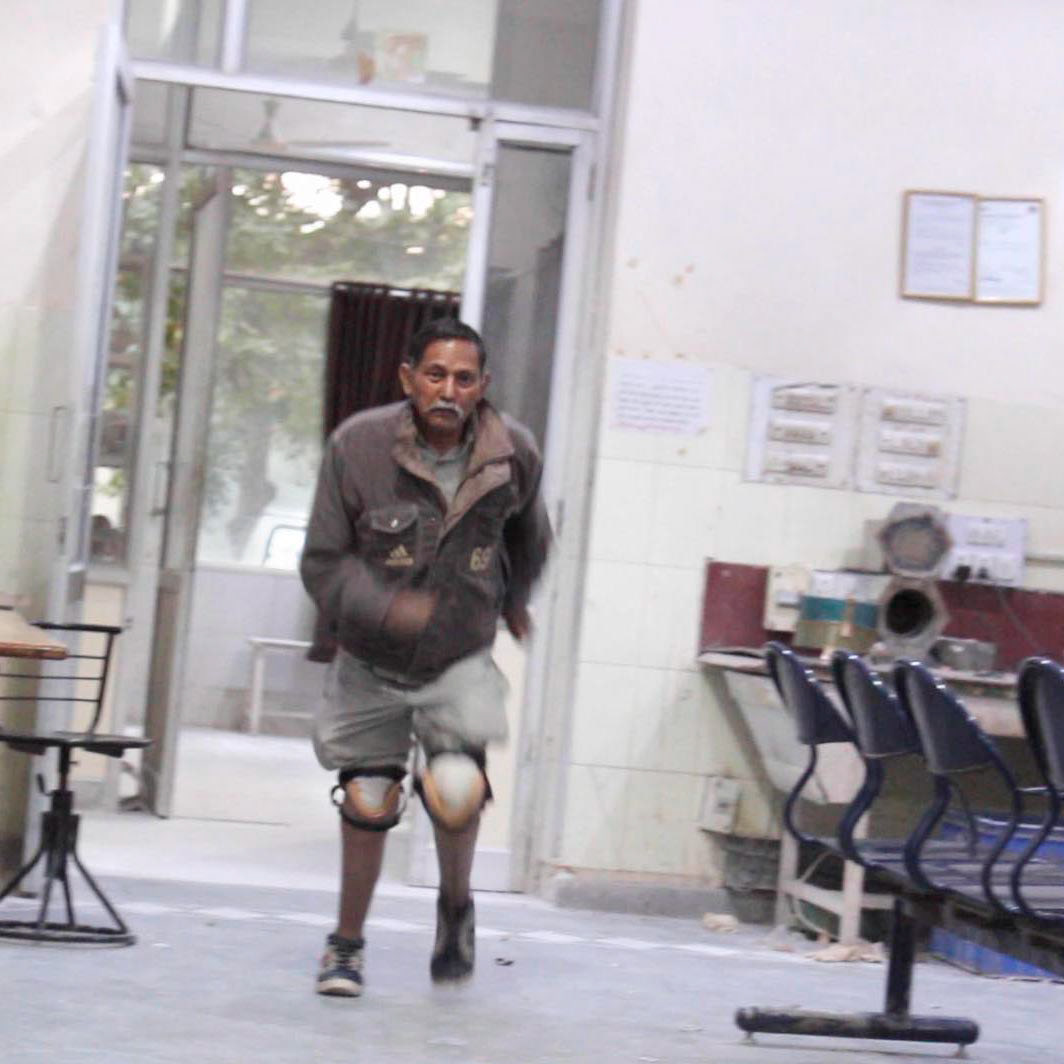 Today, he proudly demonstrates his running ability with two new legs.