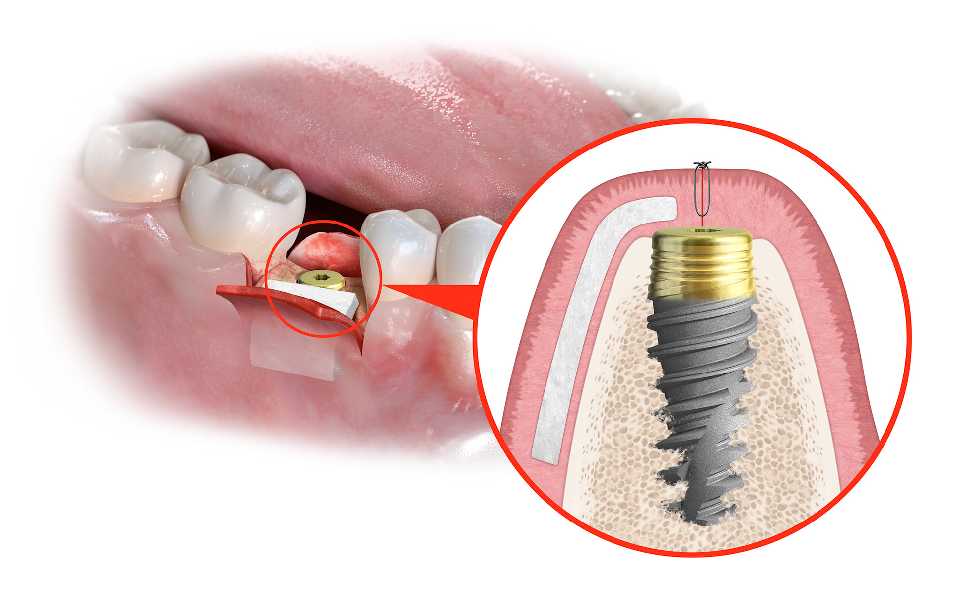 Client: Nobelbiocare