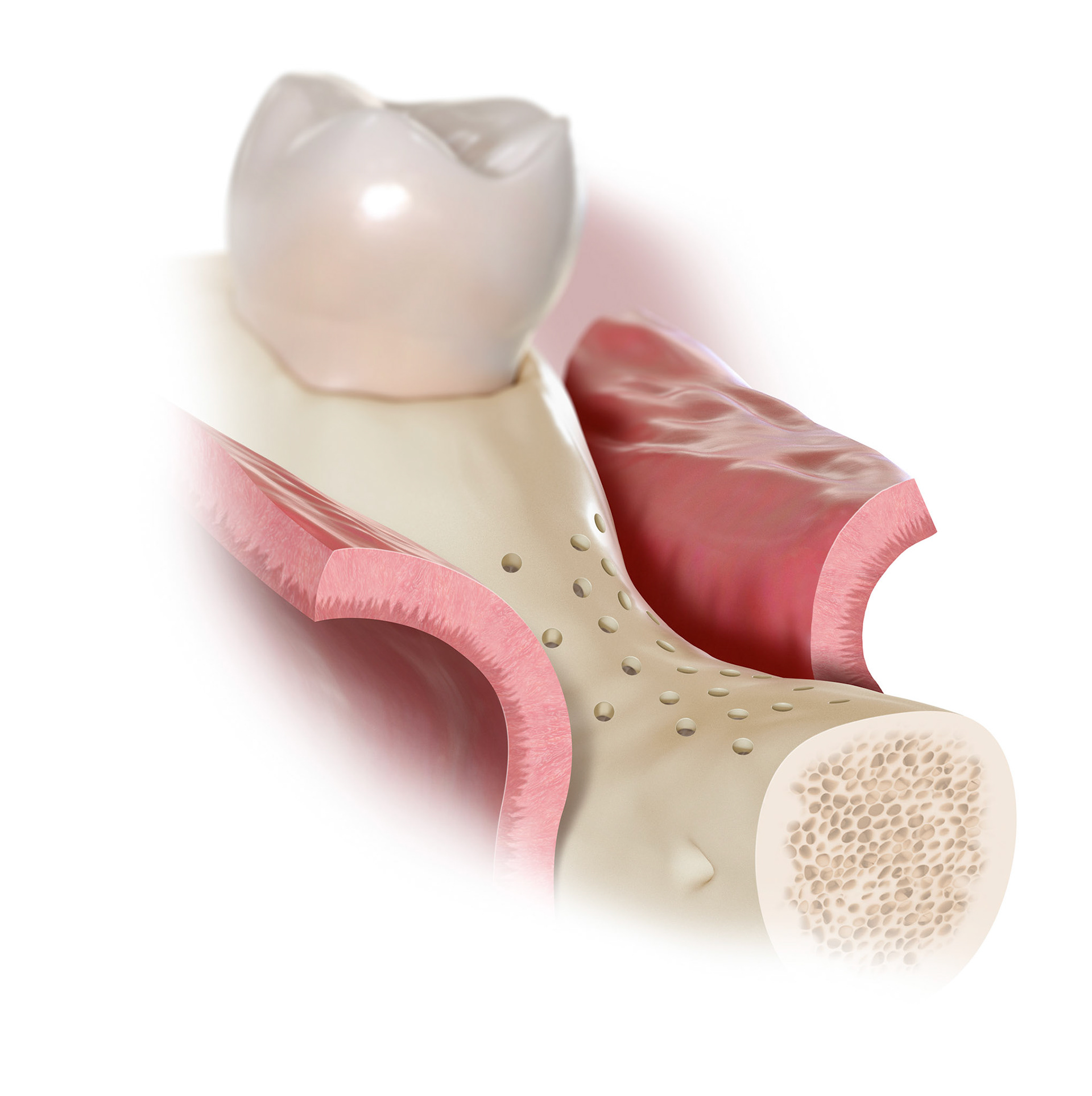 Client: Nobelbiocare