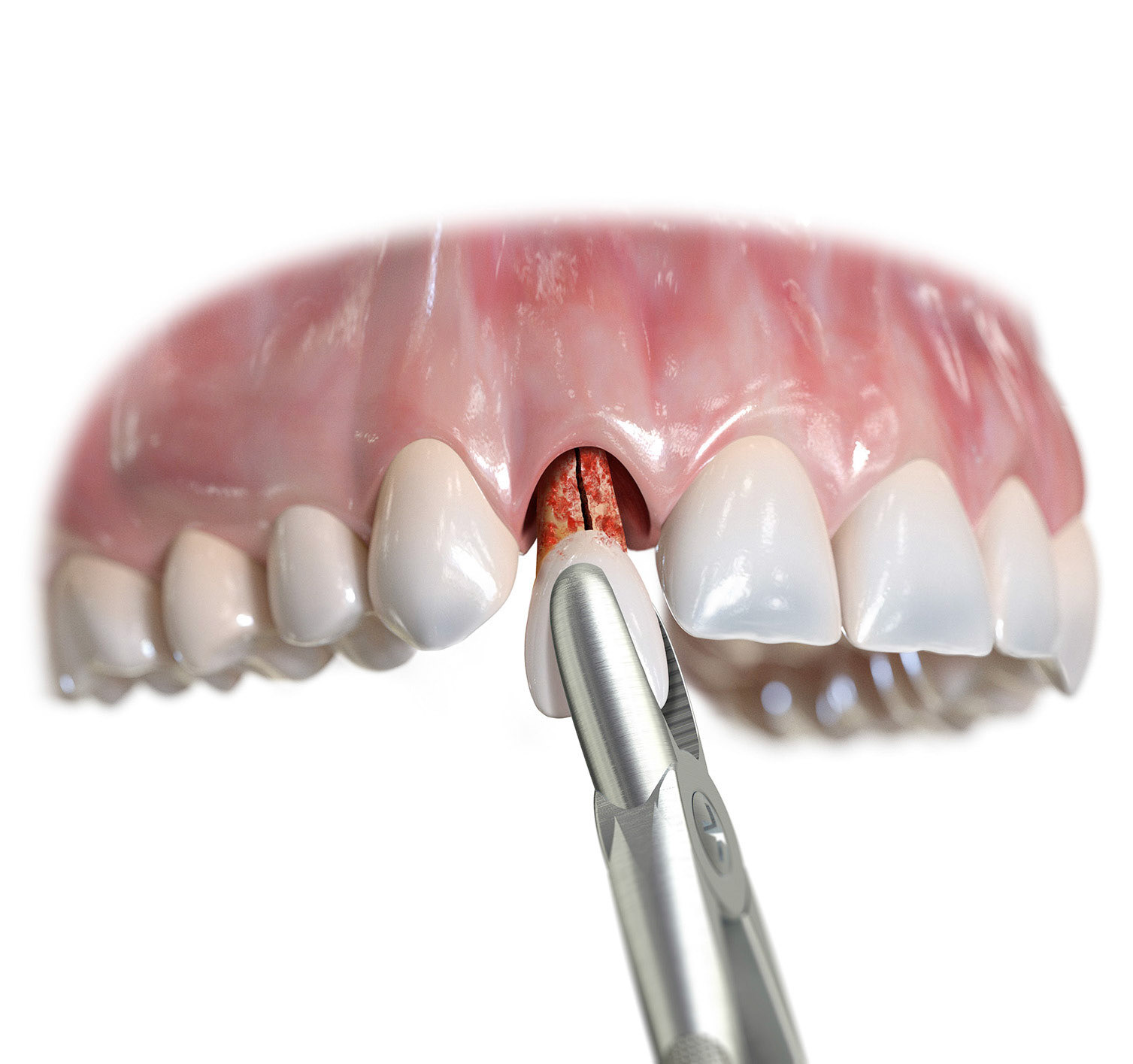 Client: Nobelbiocare