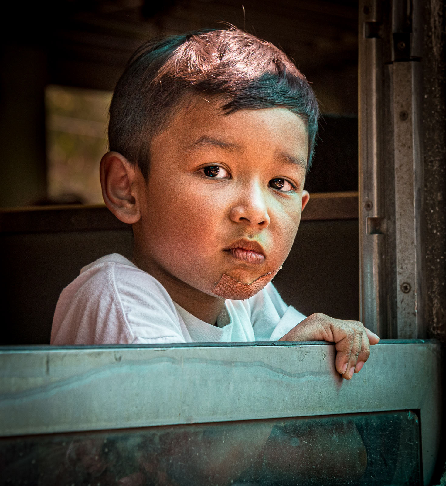 Boy with Plaster on Chin