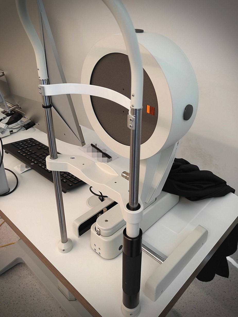 Competing device: OCULUS Pentacam