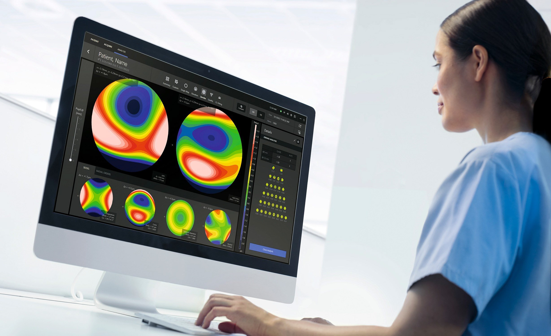 Corneal topography analysis