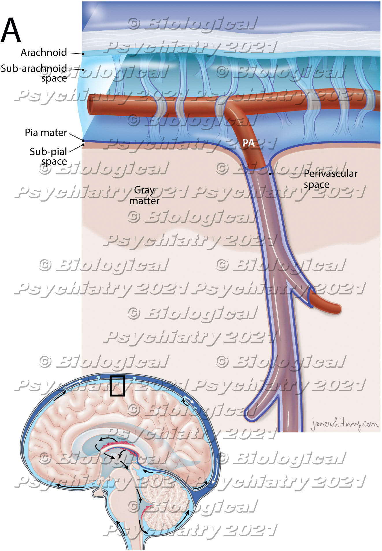 Perivascular spaces, also known as Virchow-Robin spaces are fluid-filled spaces in the brain that surrounds small arterioles, capillaries and venules in the brain.Biological Psychiatry https://doi.org/10.1016/j.biopsych.2021.06.025