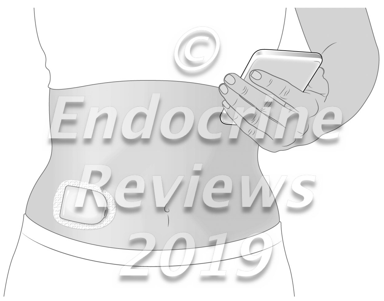 Omnipod Horizon automated insulin delivery and PDM app on smartphone