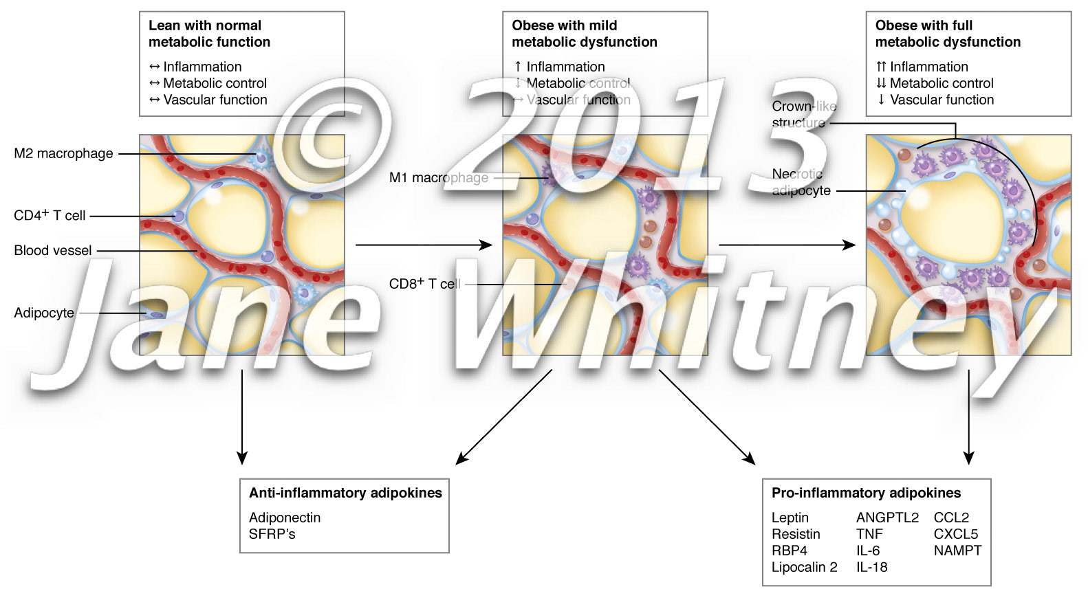 Lean or obese adipose tissue, inflammation