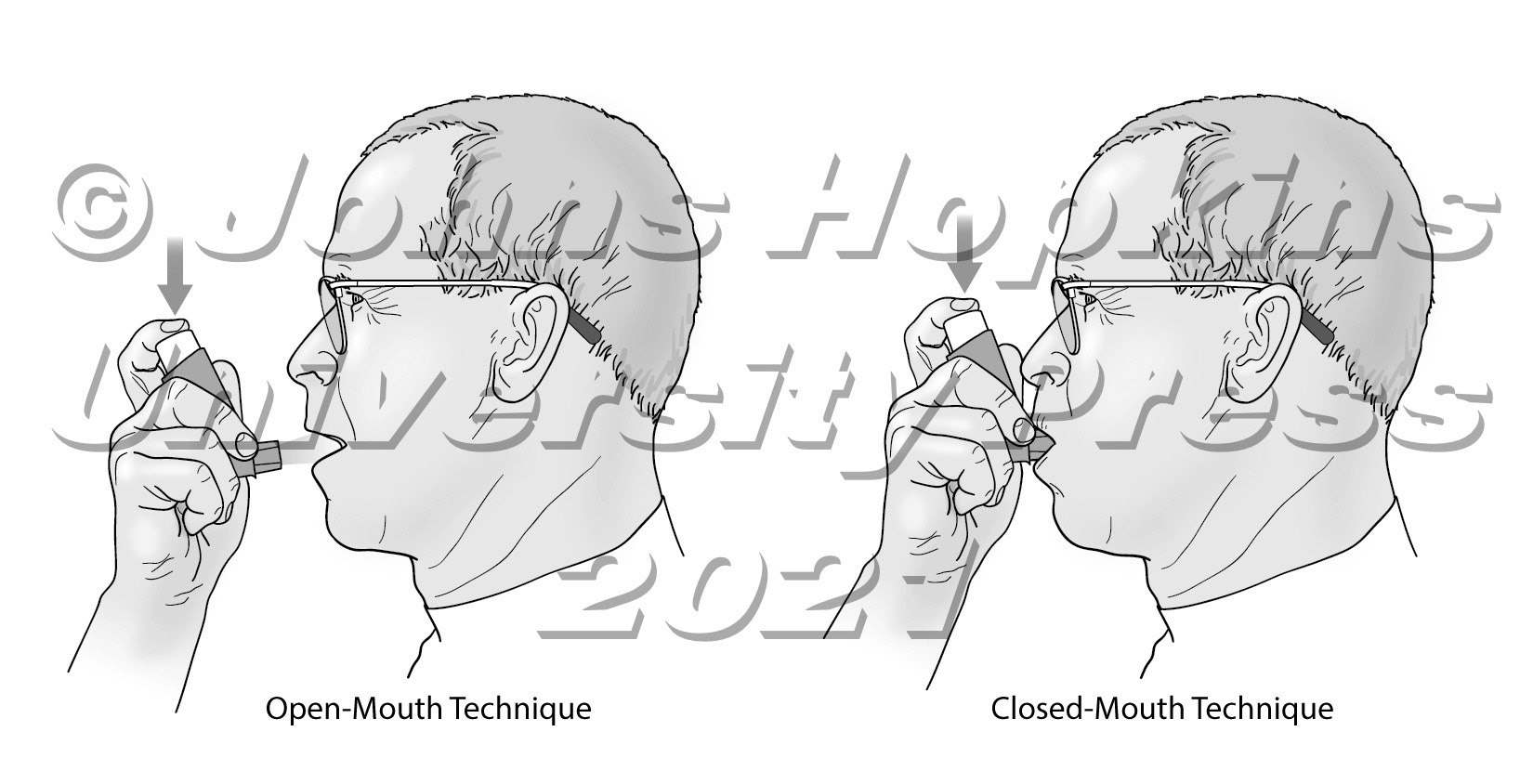 How to use an inhaler