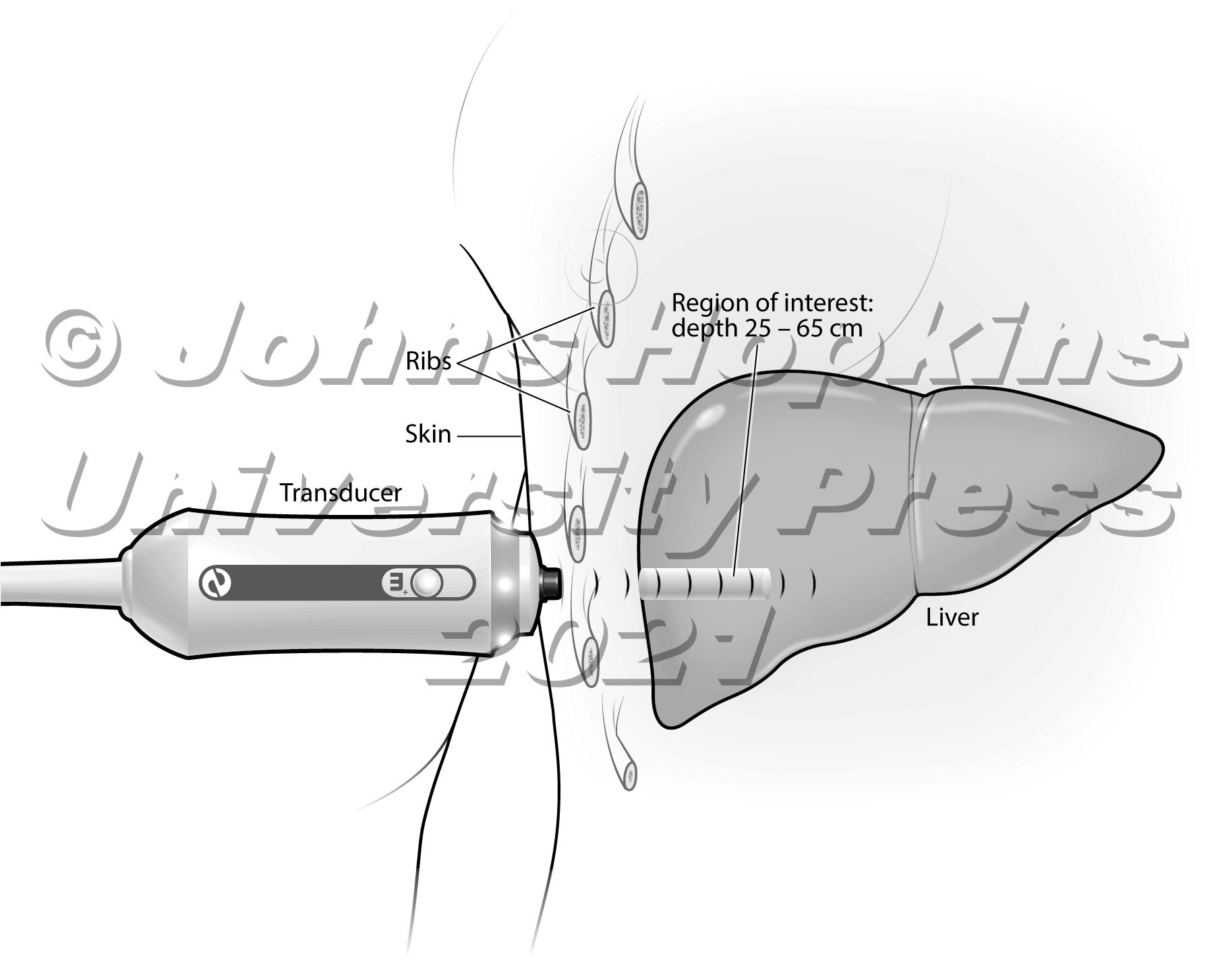 Transient elastography of the liver