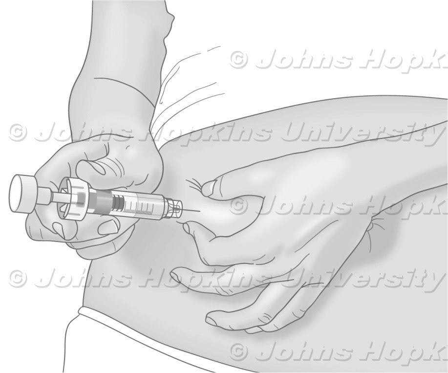 Administering subcutaneous injections