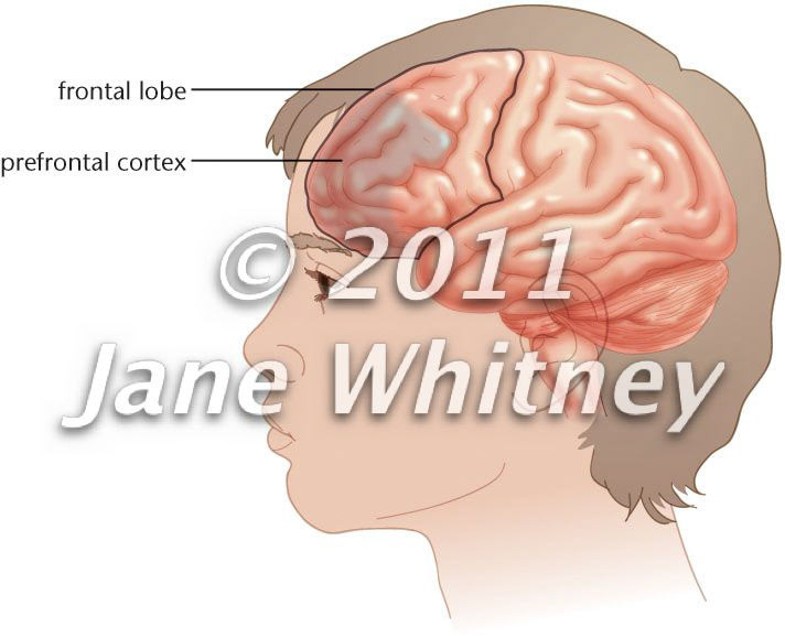 Adolescent brain