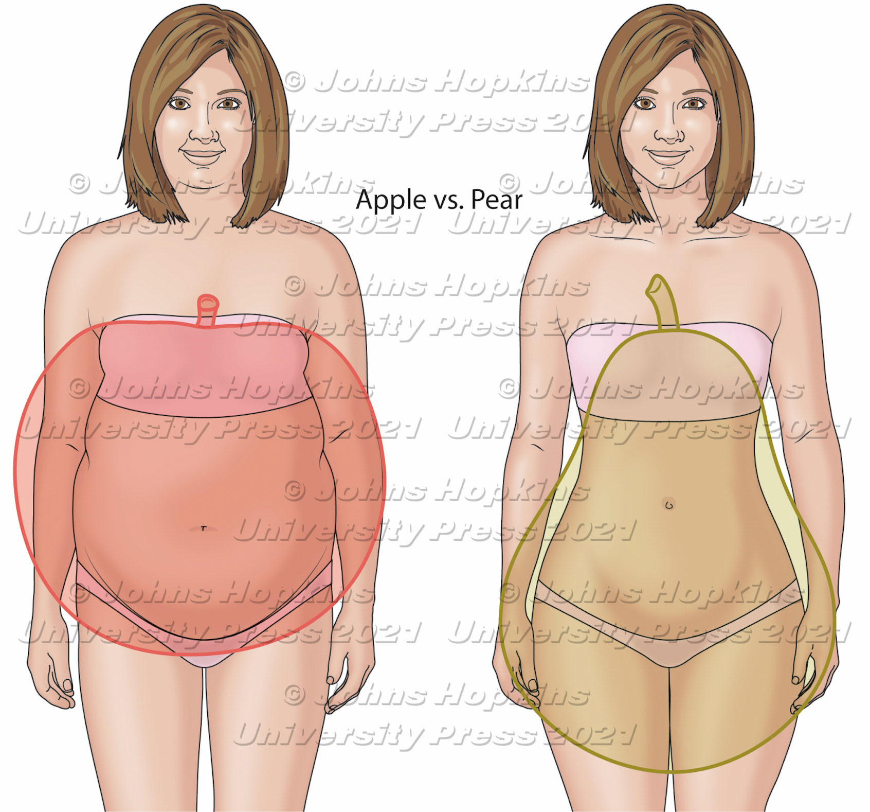 Two women with similar BMI but different fat distribution