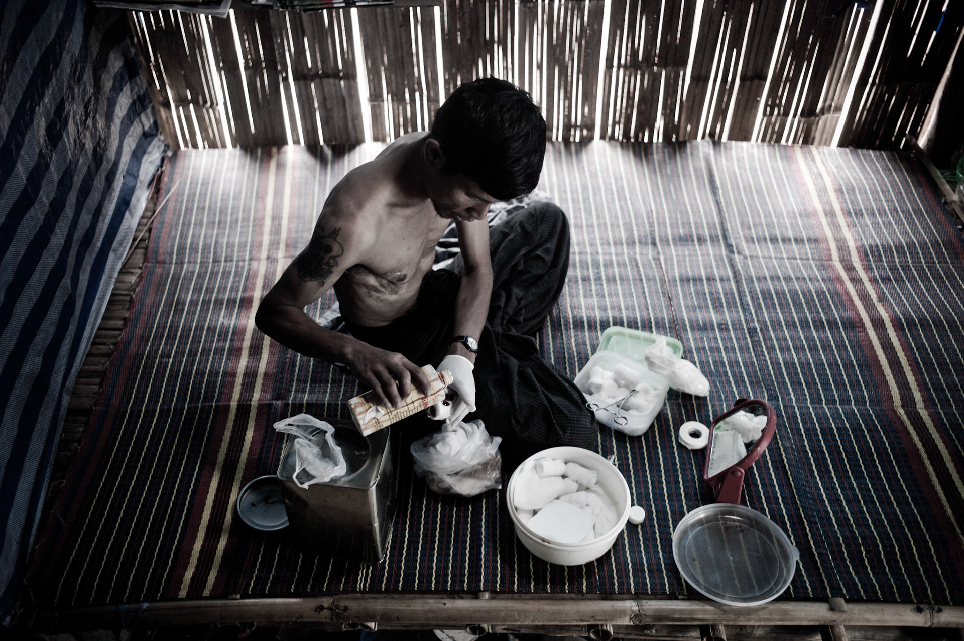 Tun Lin Kyaw was brutally tortured by Burma's infamous military intelligence when he was arrested that lead to having most of his right lung being removed. He received no medical treatment whilst in jail and nearly died from infection. Every day he has to dress his wound in a rudimentary fashion as healthcare is extremely limited in the camp.