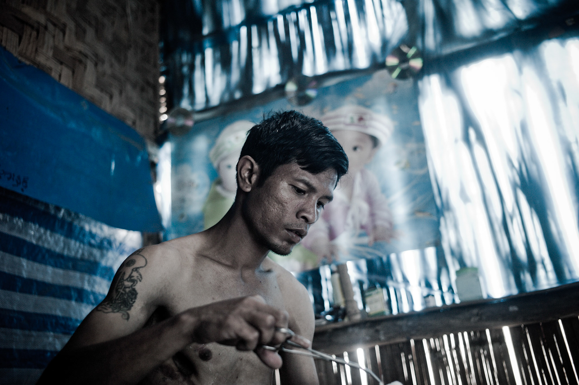 Tun Lin Kyaw was brutally tortured by Burma's infamous military intelligence when he was arrested that lead to having most of his right lung being removed. He received no medical treatment whilst in jail and nearly died from infection. Every day he has to dress his wound in a rudimentary fashion as healthcare is extremely limited in the camp.