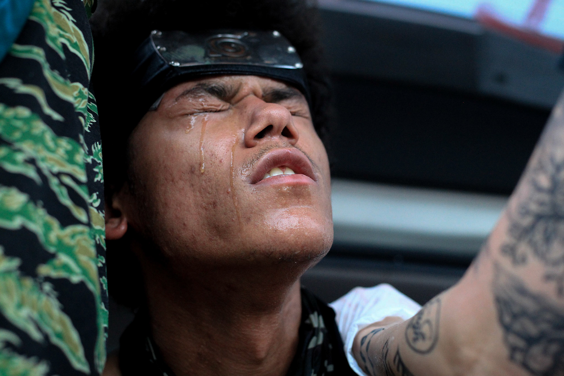 Milwaukee, WI, June 2, 2020.. A protester received a rubber bullet on his shoulder during confrontation between the police and the protesters, police shot down protesters.