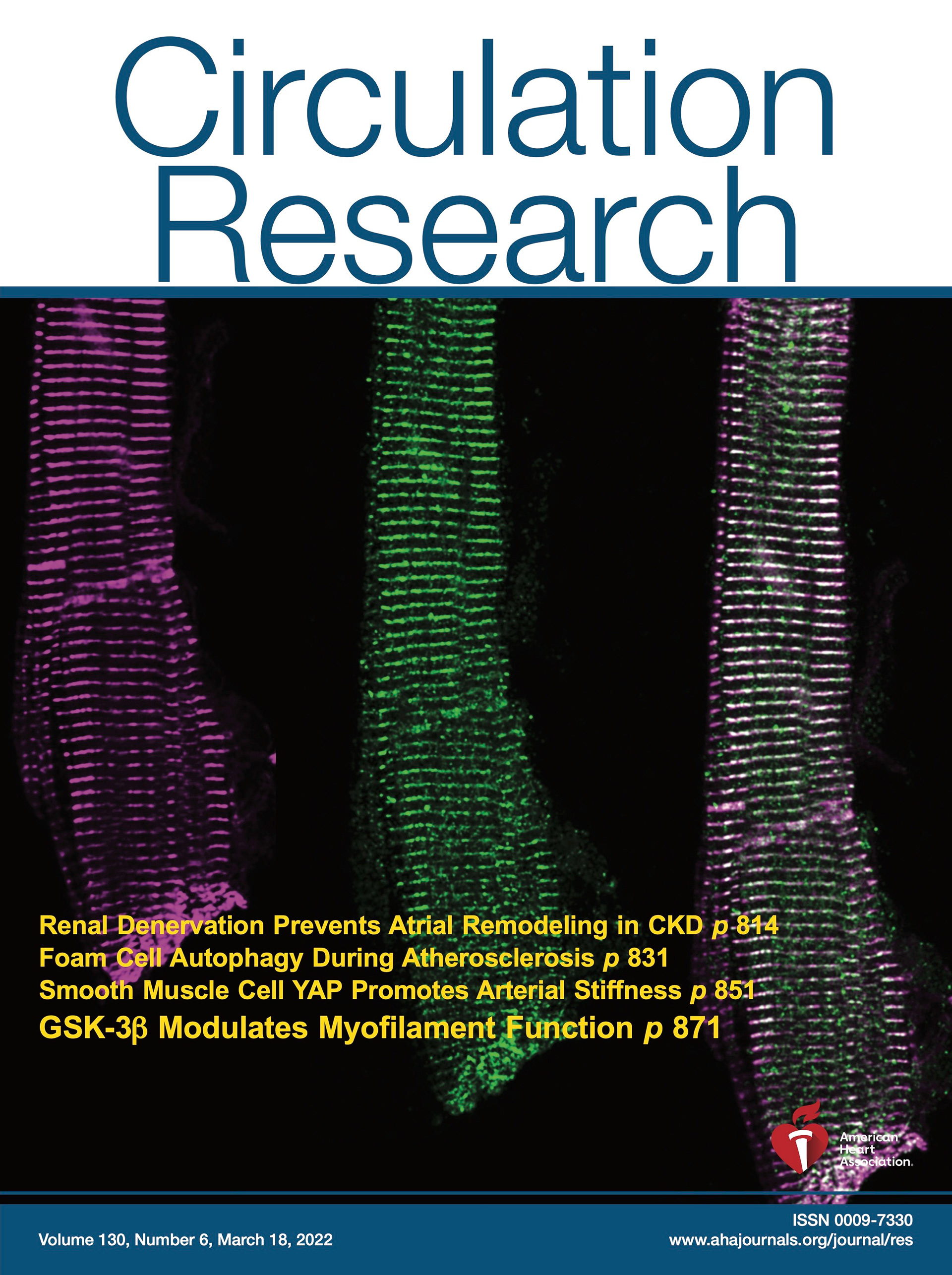Stachowski-Doll MJ, Papadaki M, Martin TG, Ma W, Gong HM, Shao S, Shen S, Muntu NA, Kumar M, Perez E, Martin JL, Moravec CS, Sadayappan S, Campbell SG, Irving T, Kirk JA. GSK-3β Localizes to the Cardiac Z-Disc to Maintain Length Dependent Activation. Circulation Research, 2022, PMID: 35168370