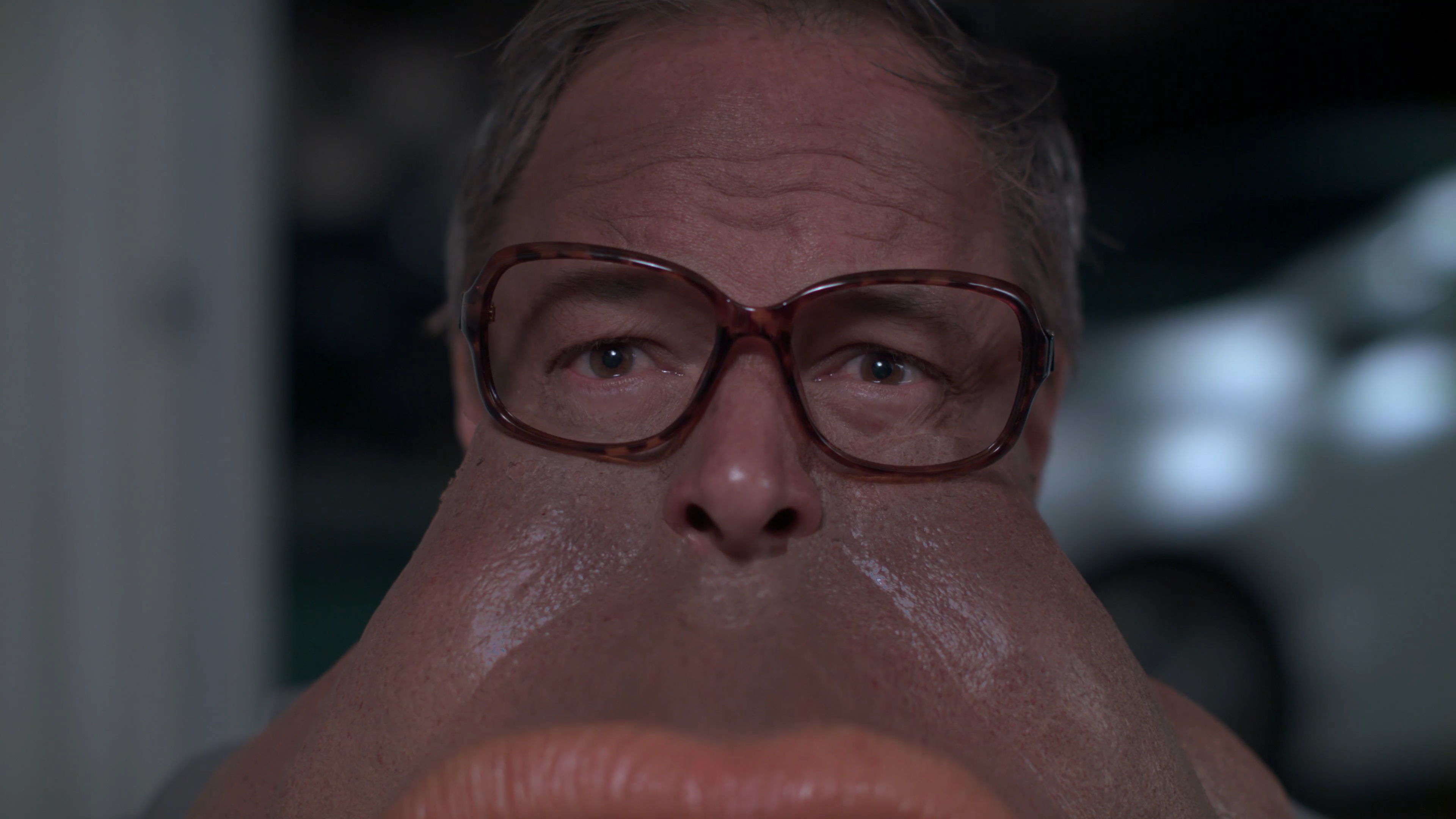 Prosthetic Blending