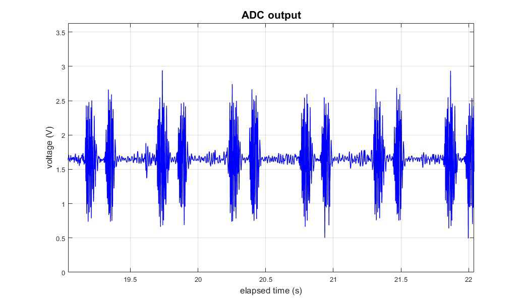 Electronic Stethoscope: digitized trace of our recorded heart sound