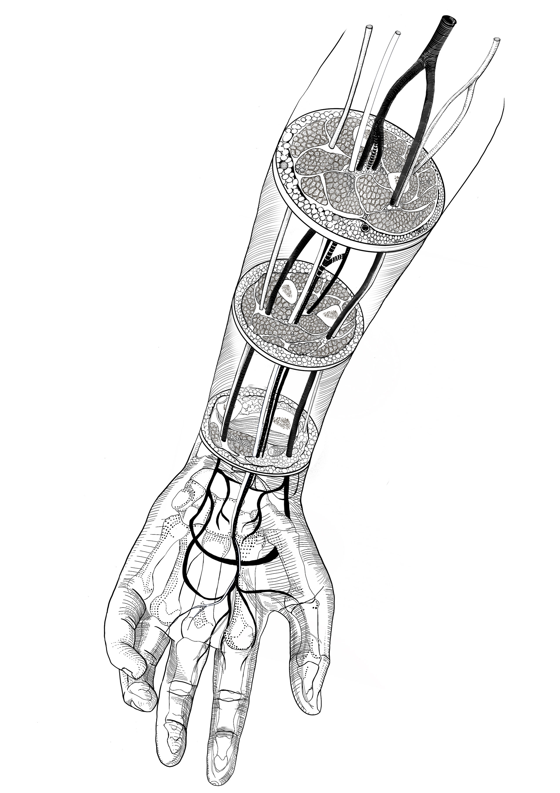 Median Artery_Sketch4