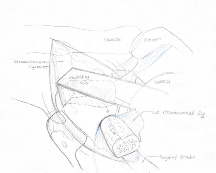 Thumbnail sketches 004